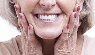 Closeup of smiling woman with new All-On-4/ Pro Arch dental implants in San Antonio
