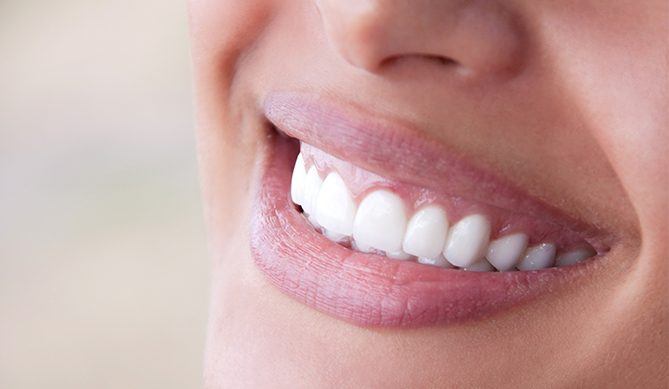 Closeup of smile after gum grafting