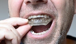 A woman receiving a dental checkup from her dentist 