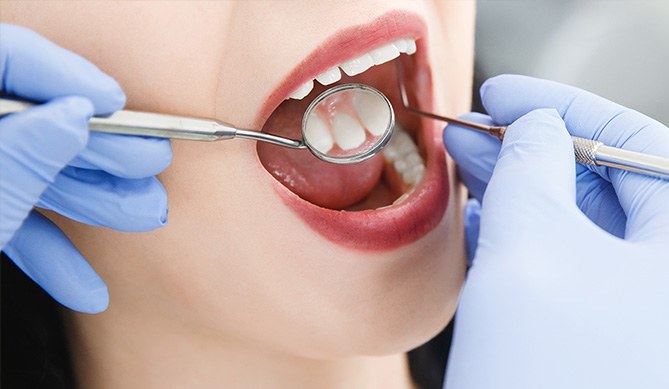 Dentist performing oral cancer screening