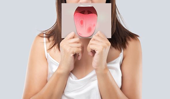  Woman holding image of tongue with oral cancer in front of her mouth