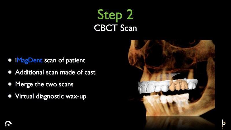 3 D rendering of skull and smile with replaced teeth