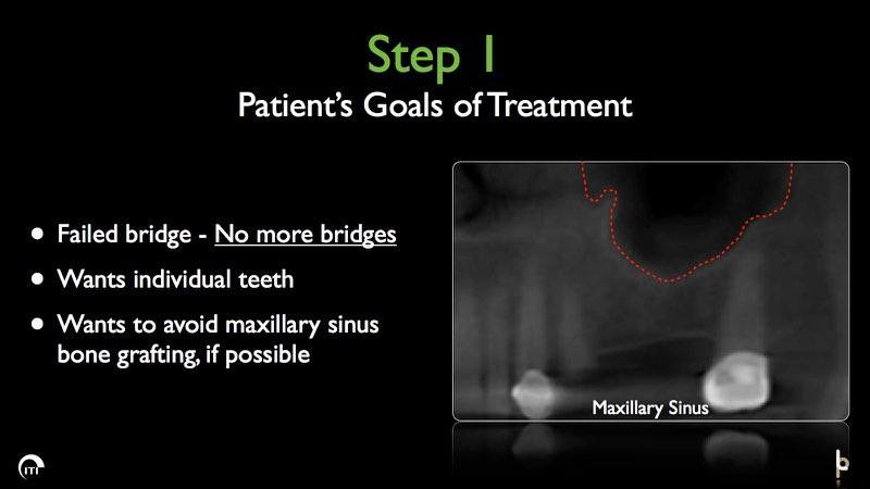 X-ray of damaged dental bridge and maxillary sinus