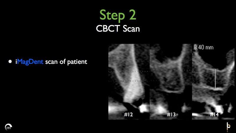 Three C B C T scans of teeth