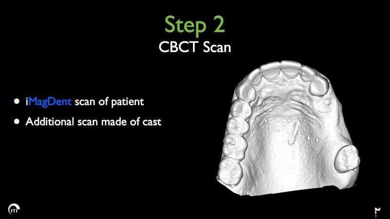 Digital impression of smile with missing teeth