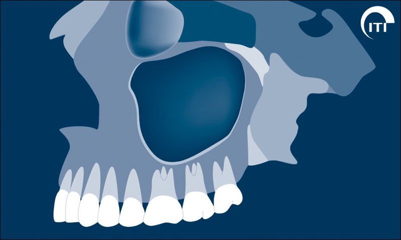 Animated rendering of the patient's profile