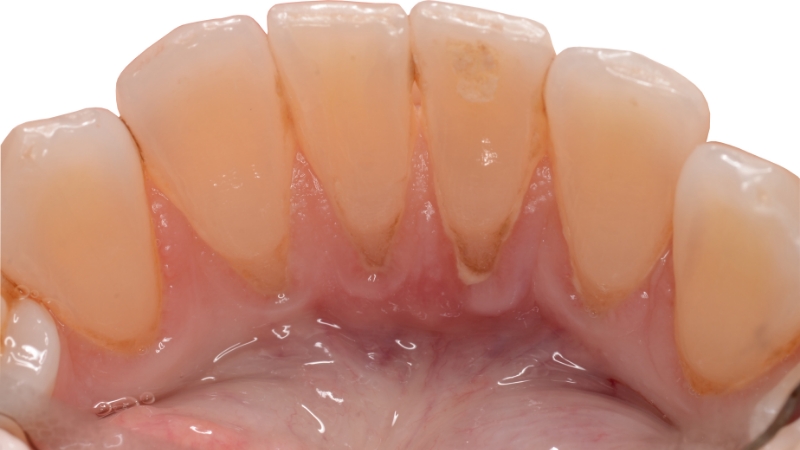 Cloeup of healthy smile