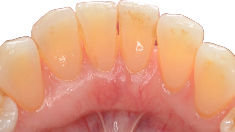Cloeup of healthy smile
