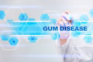 Dentist using technology for gum disease in San Antonio